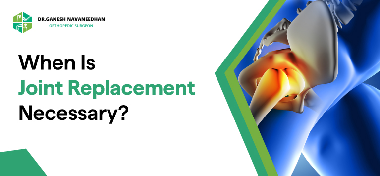 When Is Joint Replacement Necessary?