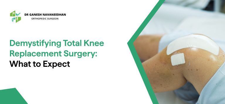 Demystifying Total Knee Replacement Surgery: What to Expect