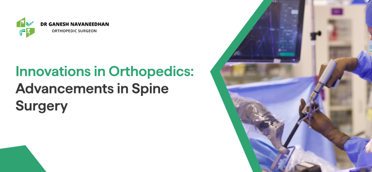 Innovations in Orthopedics: Advancements in Spine Surgery