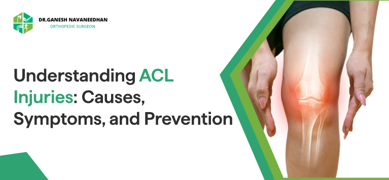 Understanding ACL Injuries: Causes, Symptoms, and Prevention