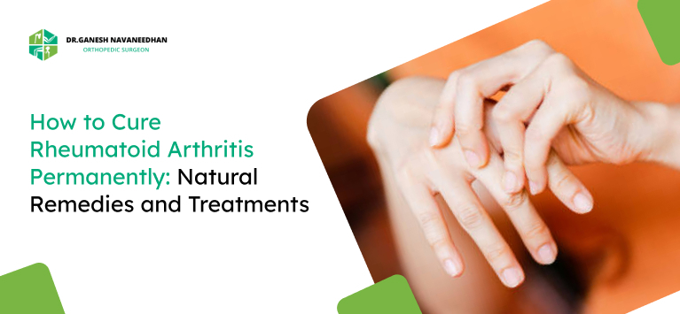 How to Cure Rheumatoid Arthritis Permanently: Natural Remedies and Treatments